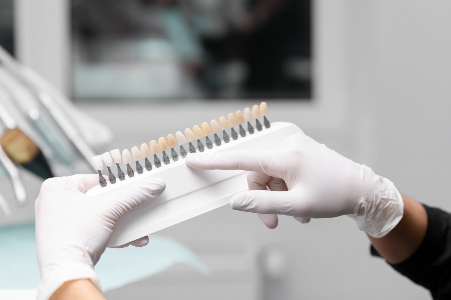faccette-dental